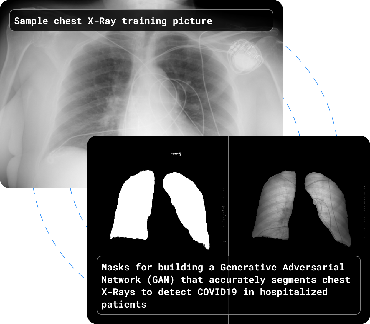 Left: Sample training picture
Right: Corresponding masks for building a Generative Adversarial Network (GAN) that accurately segments chest X-Rays to detect COVID19 in hospitalized patients